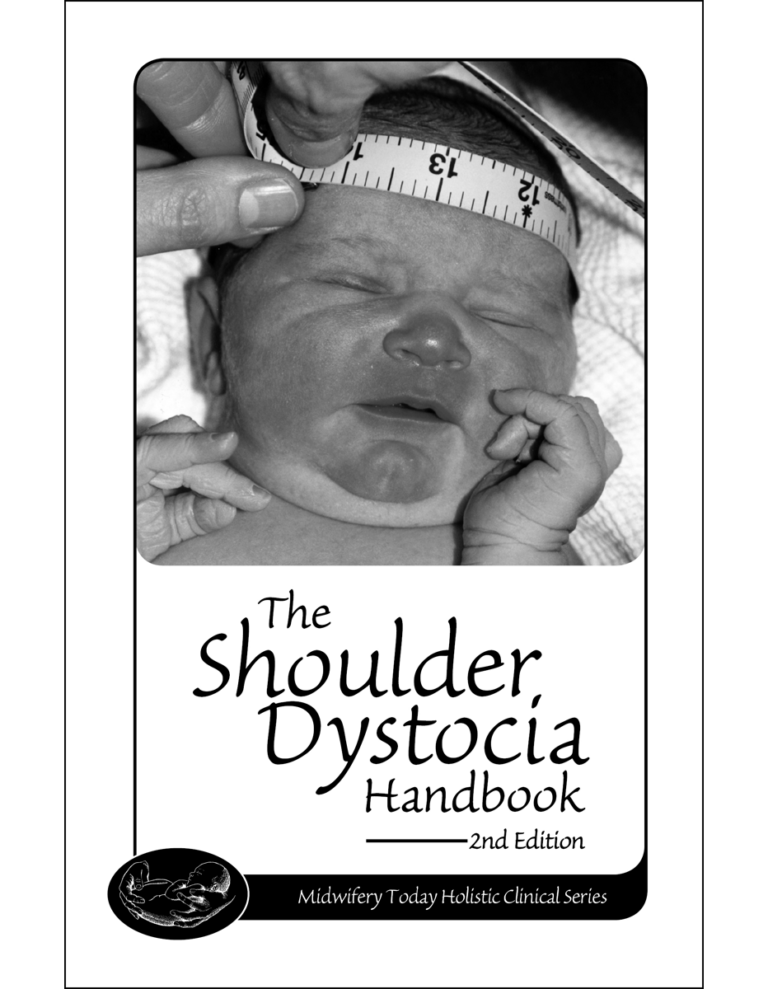 The Shoulder Dystoica Handbook, 2nd Edition