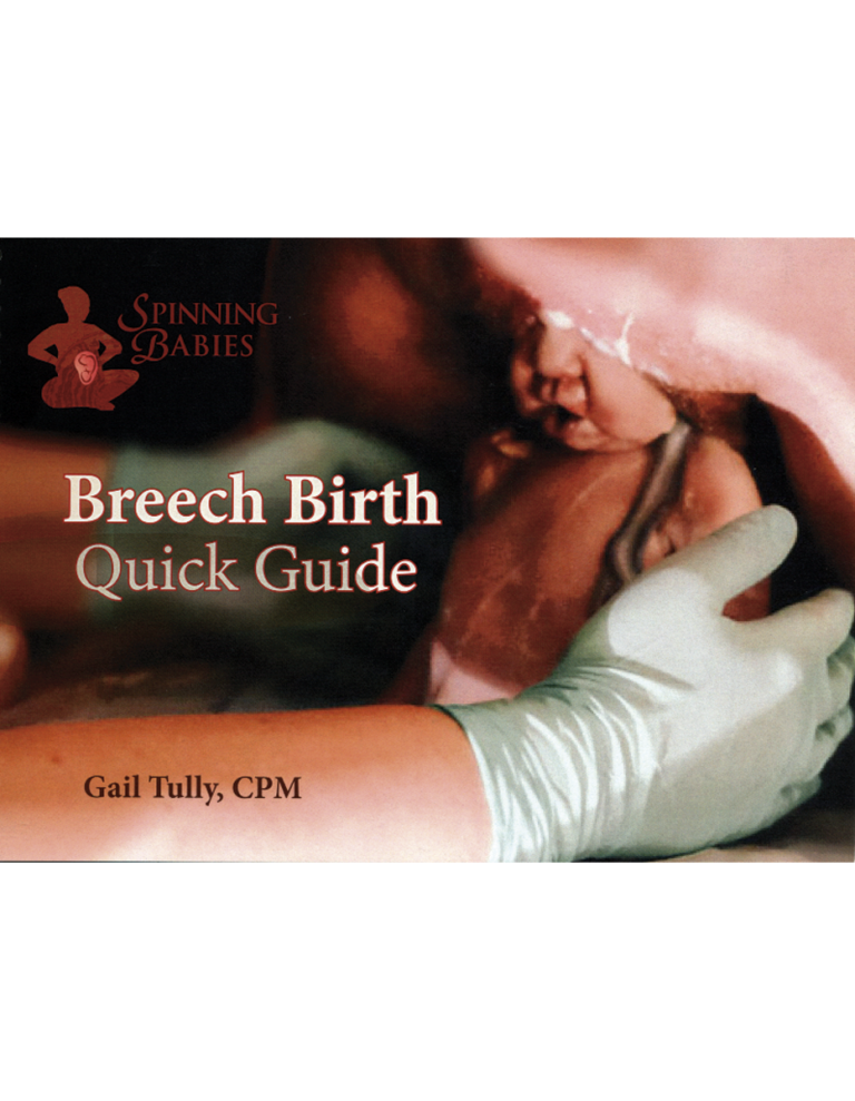 Spinning Babies Breech Birth Quick Guide