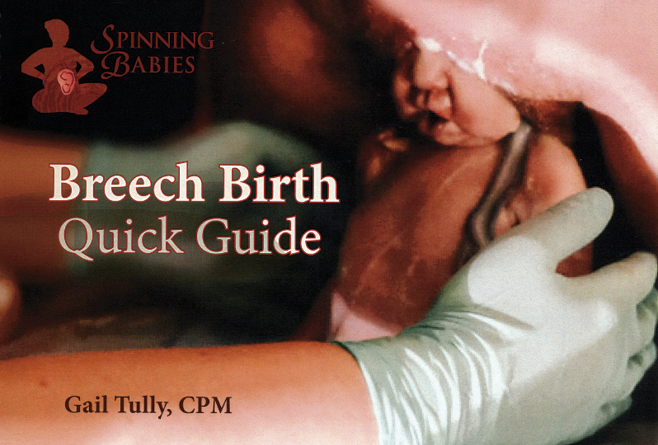 Spinning Babies Breech Birth Quick Guide